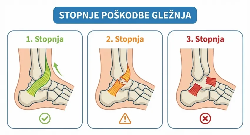 stopnje-poskodbe-vezi-gleznja-c2c0